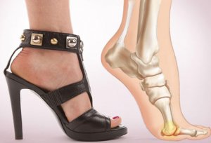 high-heels-and-bones