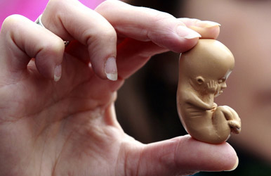 سقط جنین چه عوارضی بدنبال دارد؟