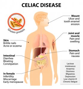 Coeliac disease or celiac disease