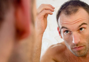 causes-of-hair-loss