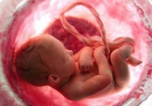 اطلاعاتی درباره علت افزایش سقط جنین