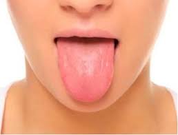 تشخیص سلامت از روی رنگ زبان