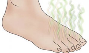 بوی پا را با راهکار سنتی رفع کنید