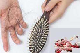 آشنایی با بیماری هایی که منجر به ریزش مو می شود