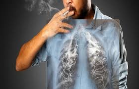 90 درصد افراد سیگاری در معرض سرطان ریه هستند