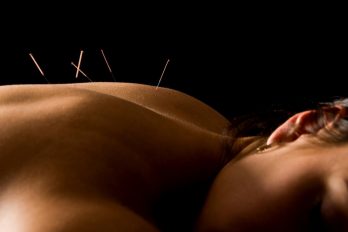 acupuncture-may-reduce-cancer-drug-side-effects