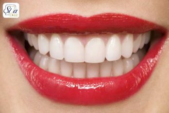 زیبایی دندان