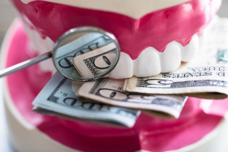 قیمت لمینت دندان چقدر است؟ لمینت به صرفه تر است یا کامپوزیت؟